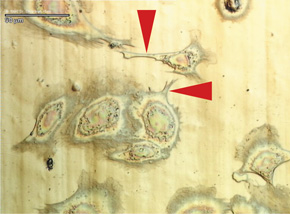 human_endothelial_cells_left